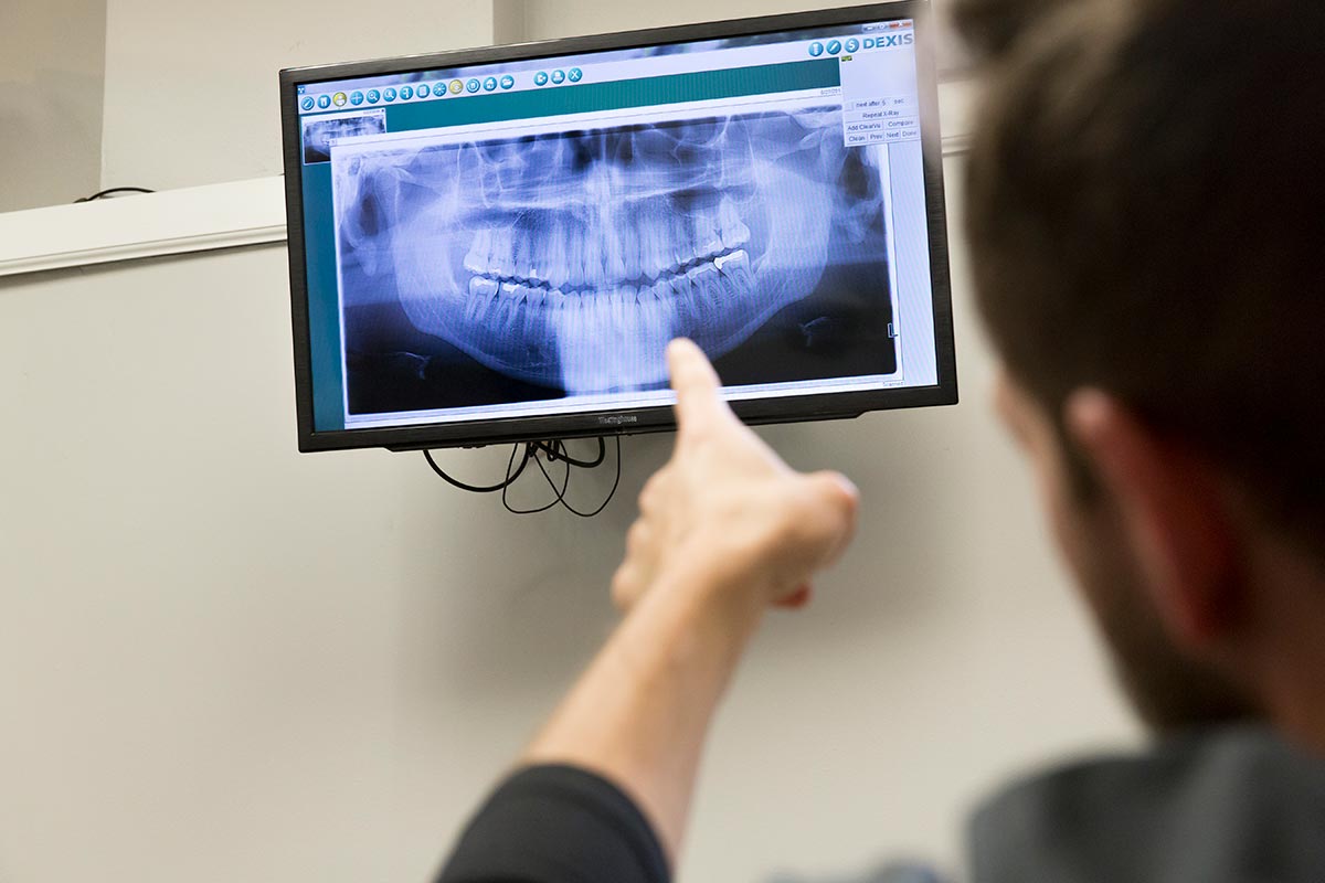 dental x-rays in Columbus